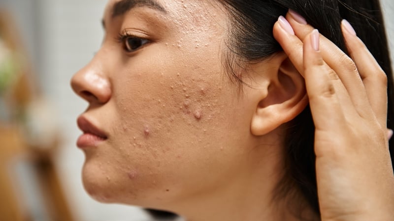 A young woman applies her skin care product, caring for her complexion and skin health.