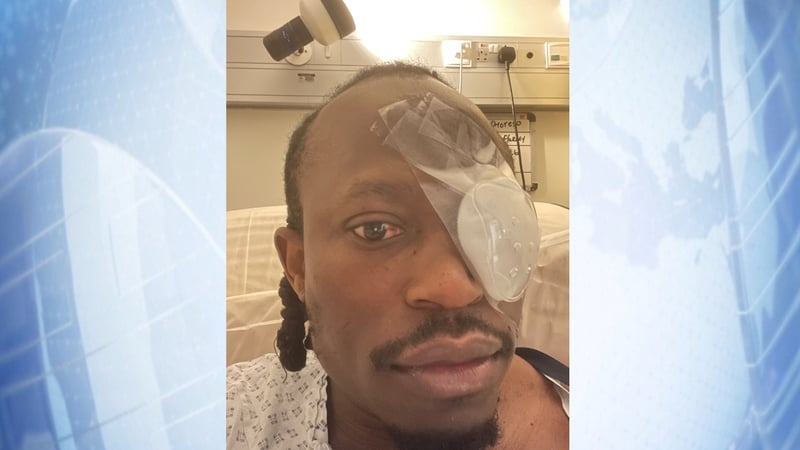 Tobi Omoteso, who was attacked in Limerick city in March