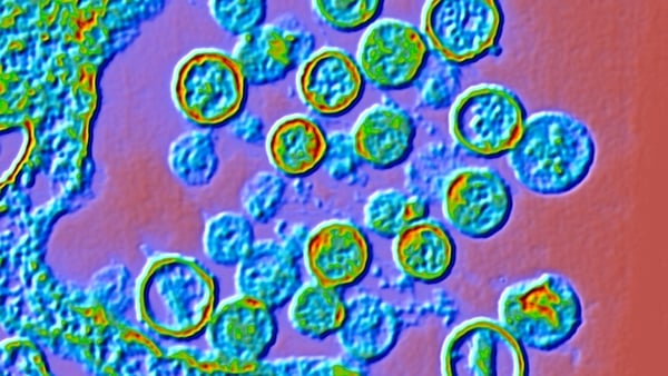 Cruise ship hantavirus outbreak 'not the start of a pandemic', says WH...