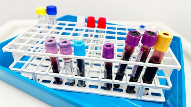 LONDON, ENGLAND - March 18: Blood tests at Charing Cross Hospital on March 18, 2026 in London, England. (Photo by Peter Dazeley/Getty Images)