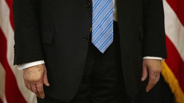 US President Donald Trump's hands are seen with makeup on the back of one of them
