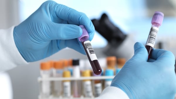 A person wearing surgical gloves holds two vials of blood in a laboratory