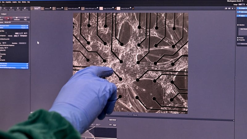 In this photo taken on May 5, 2026, senior scientific specialist Kwaku Dad Abu Bonsrah points to a image from a microscope of cortical and hippocampal cells on a cell culture plate at Cortical Labs' Physical Containment Level 2 (PC2) laboratory in Melbour