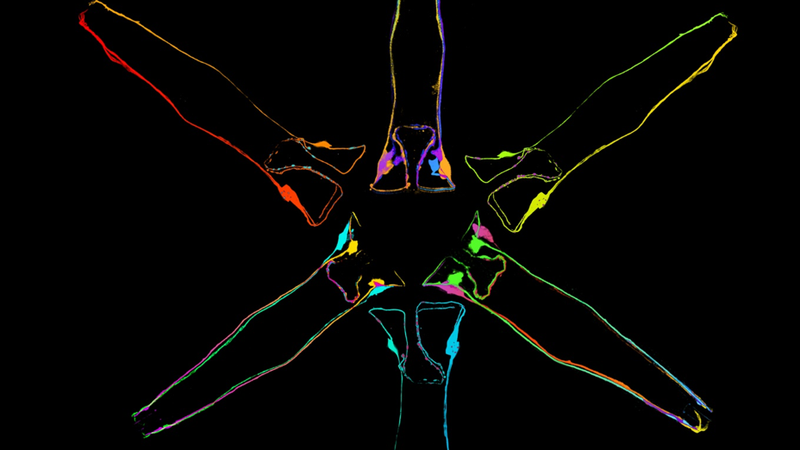 An image of nematode worms with fused neurons produced by University of Queensland researchers. Photo: Hilliard Lab, Queensland Brain Institute